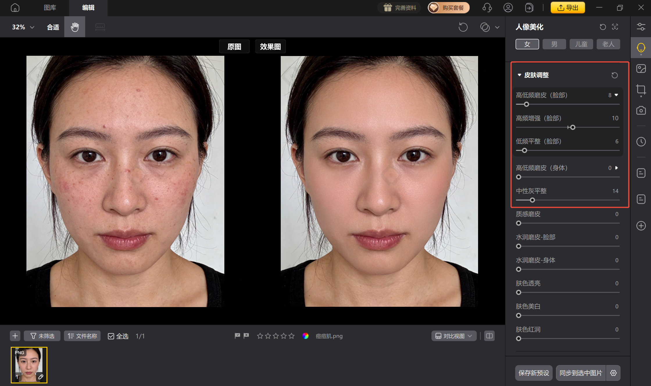 影像之匠AI皮肤修复界面