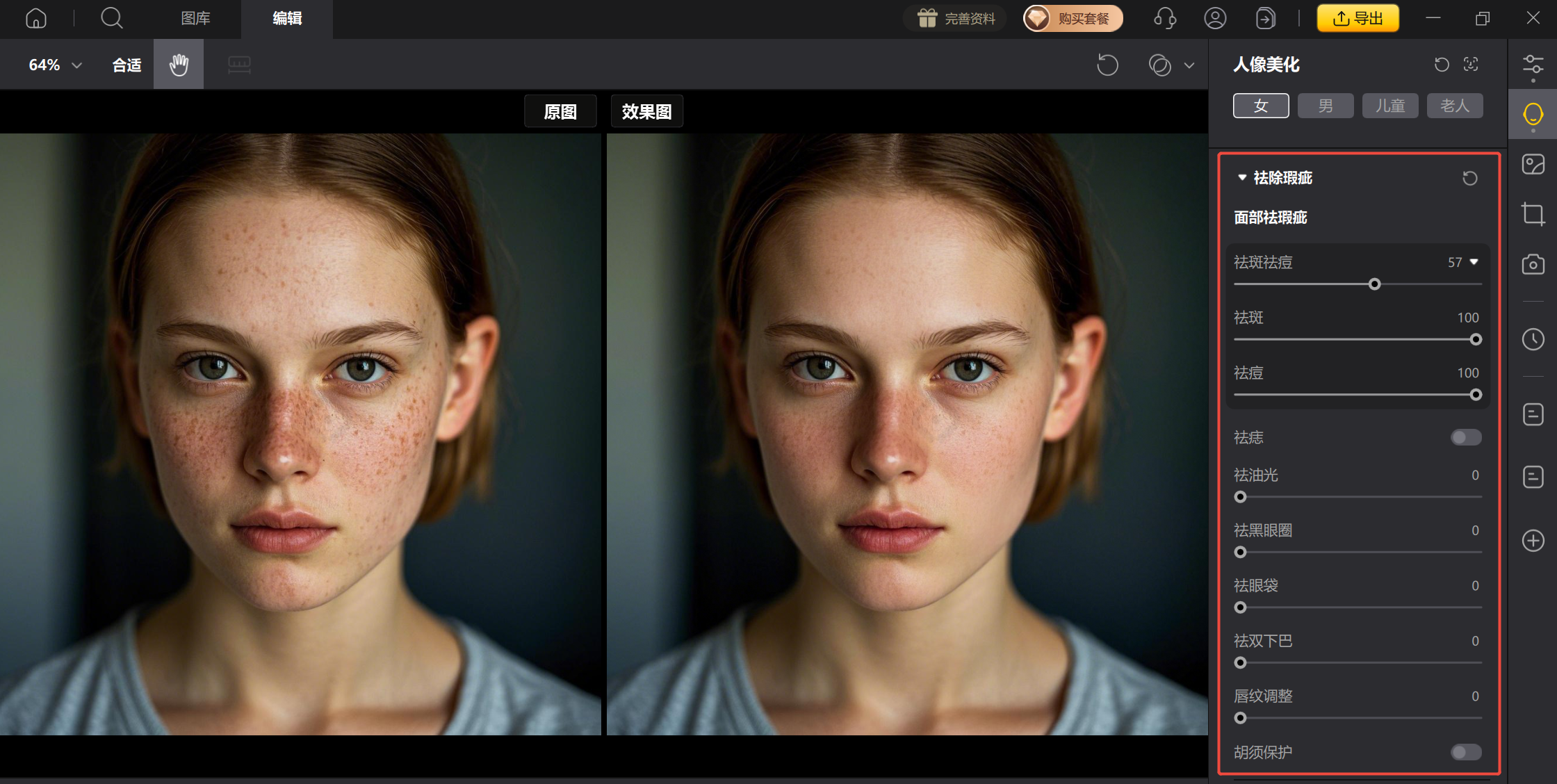 使用祛斑祛痘功能祛除瑕疵