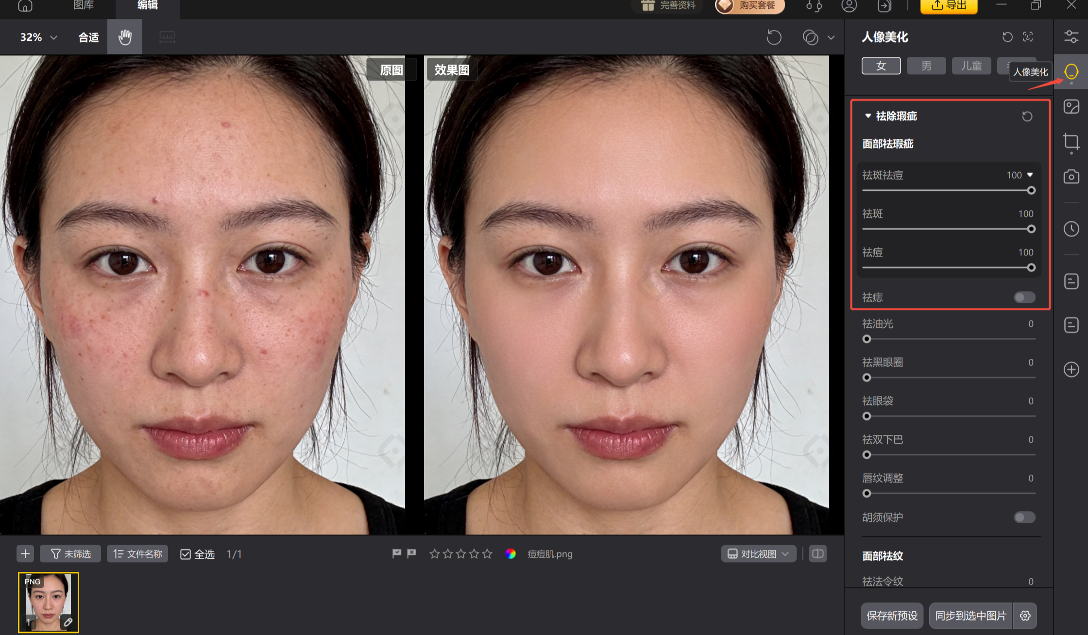 影像之匠AI祛痘界面