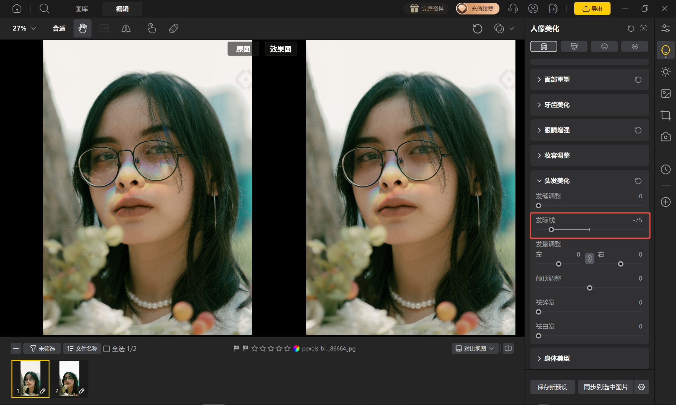 发际线调整示意