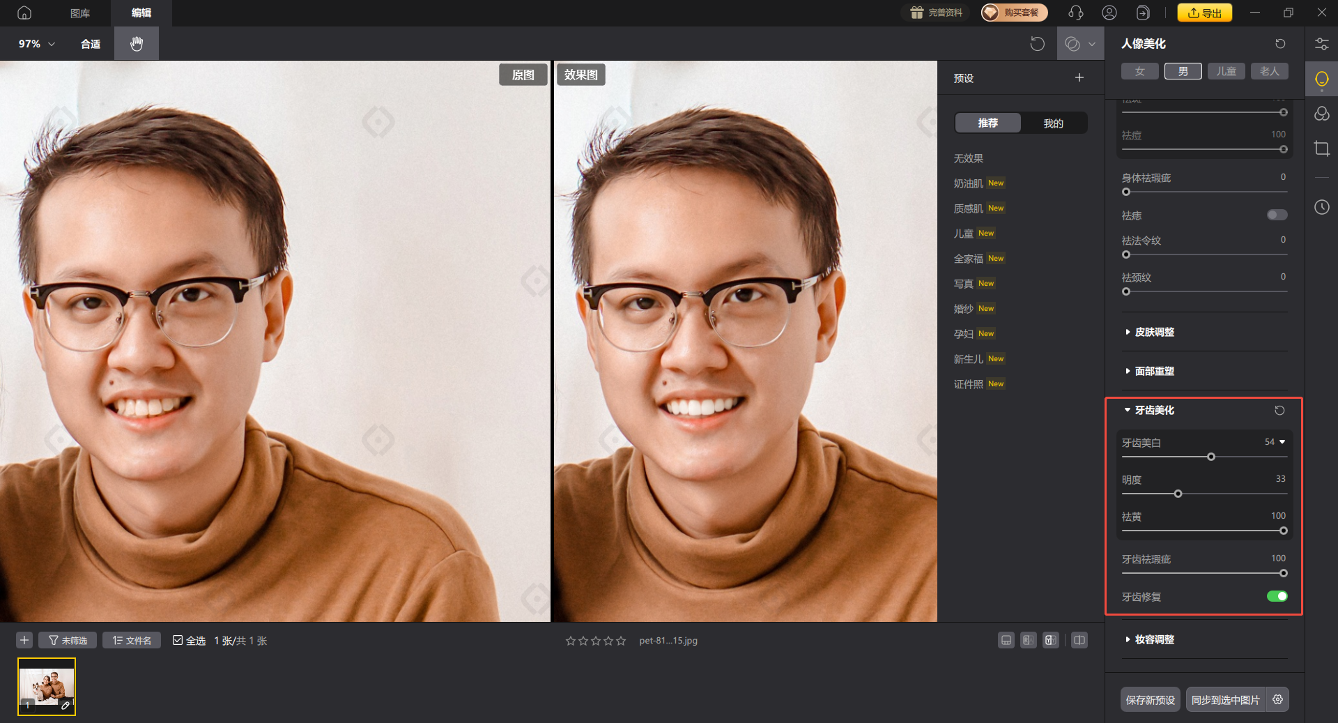 影像之匠-牙齿美化
