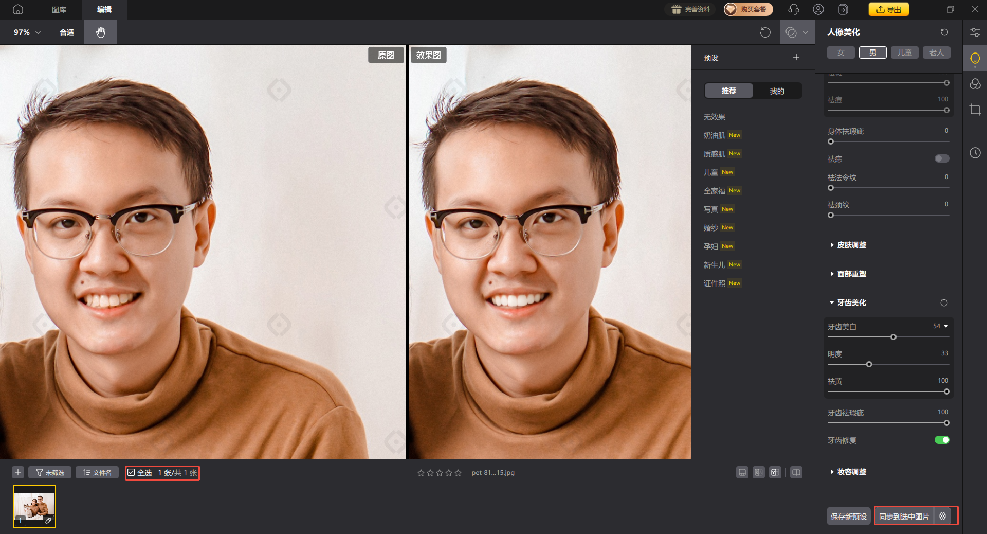 影像之匠-牙齿美化