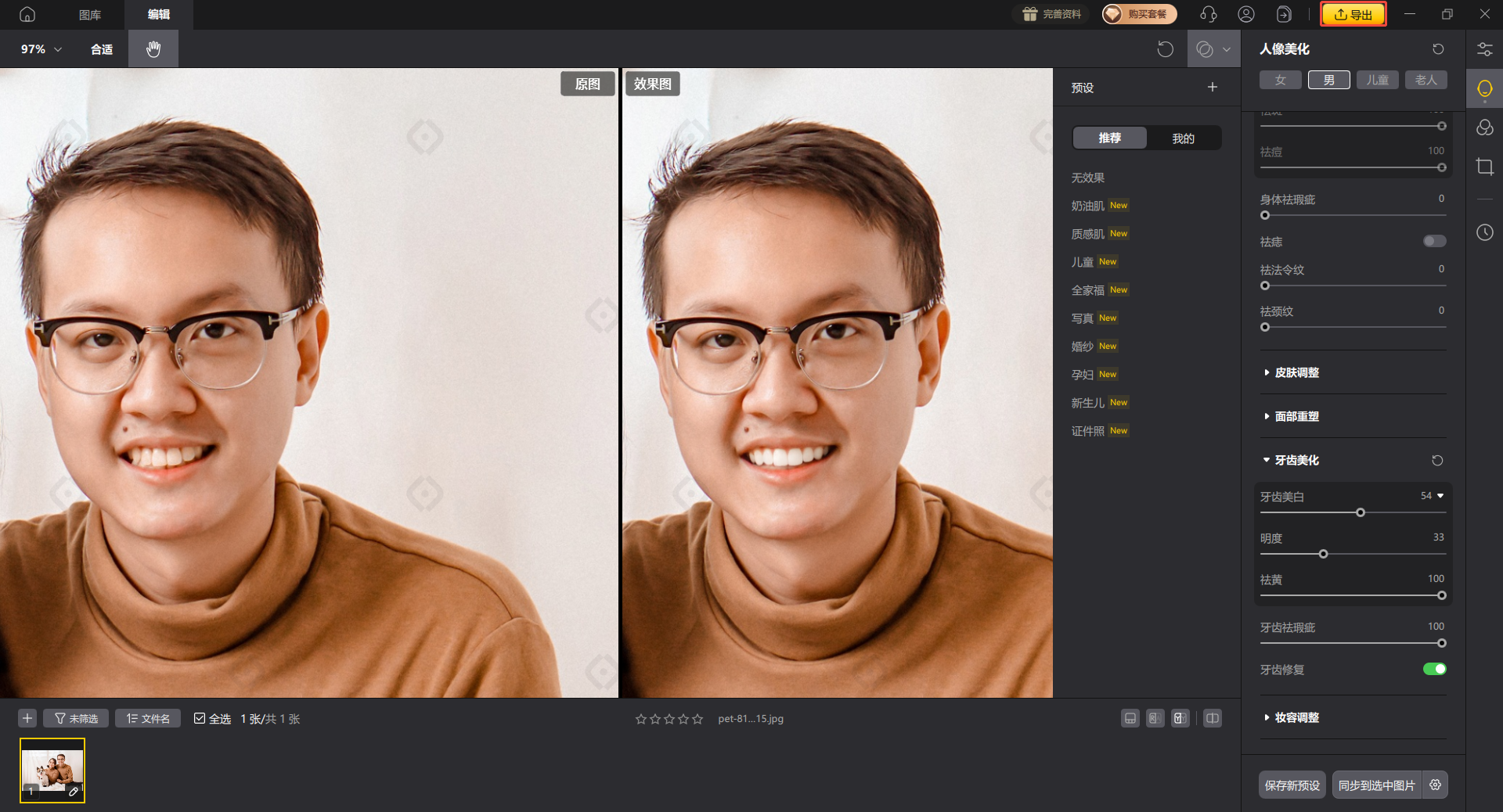 影像之匠-牙齿美化