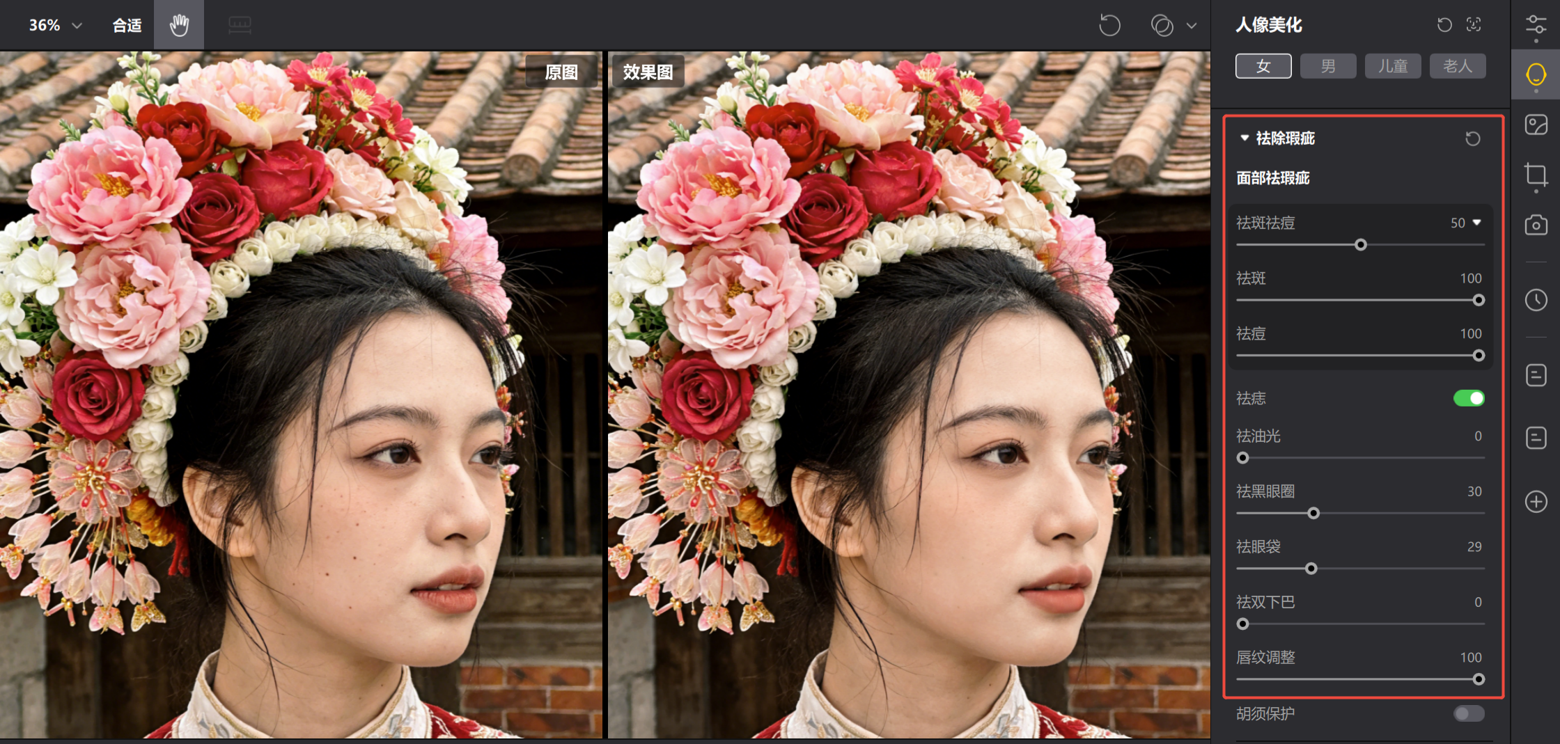 人像祛瑕疵细节对比